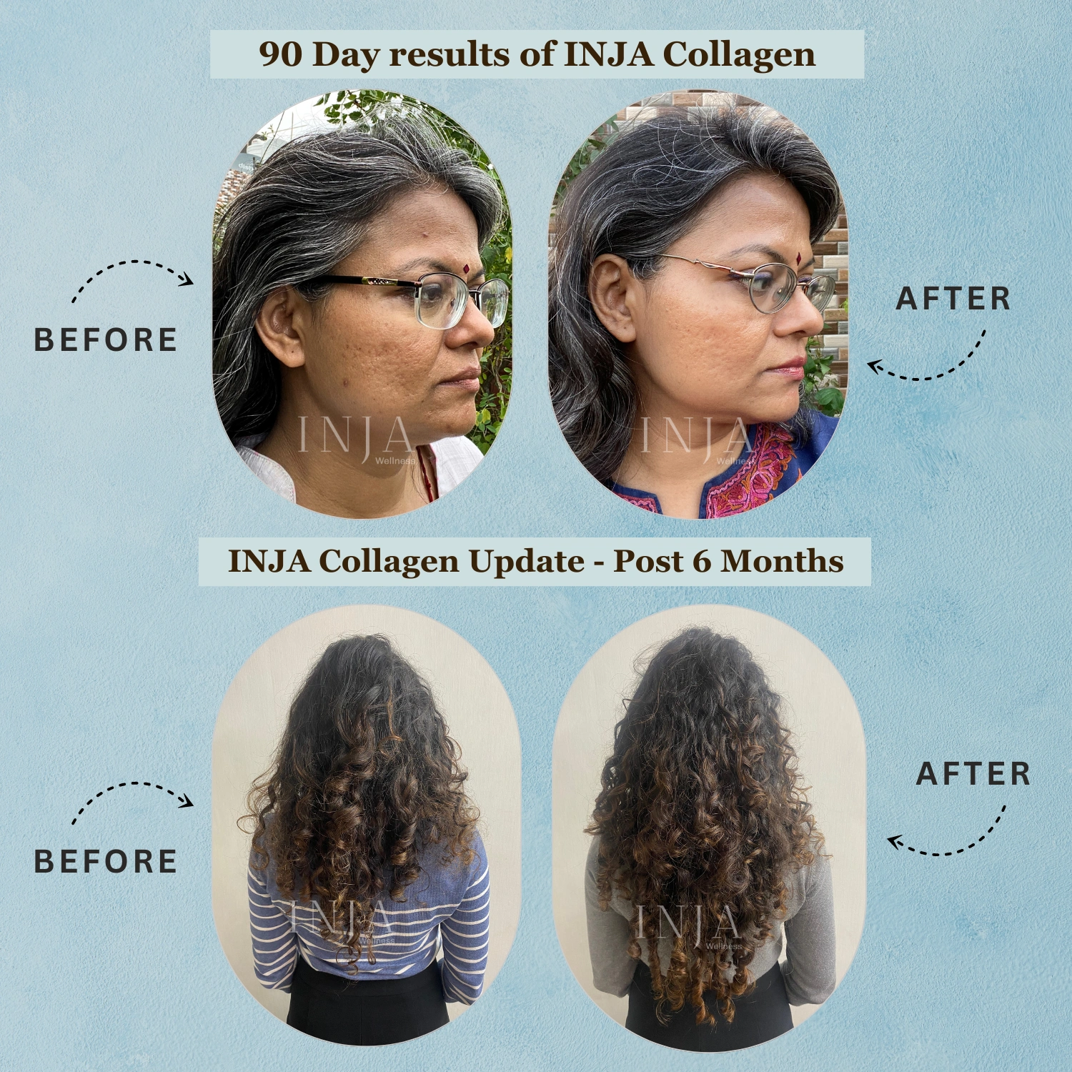 INJA Wellness Pro Finest Hydrolyzed Marine Collagen from Japan | Unflavoured - Image 5