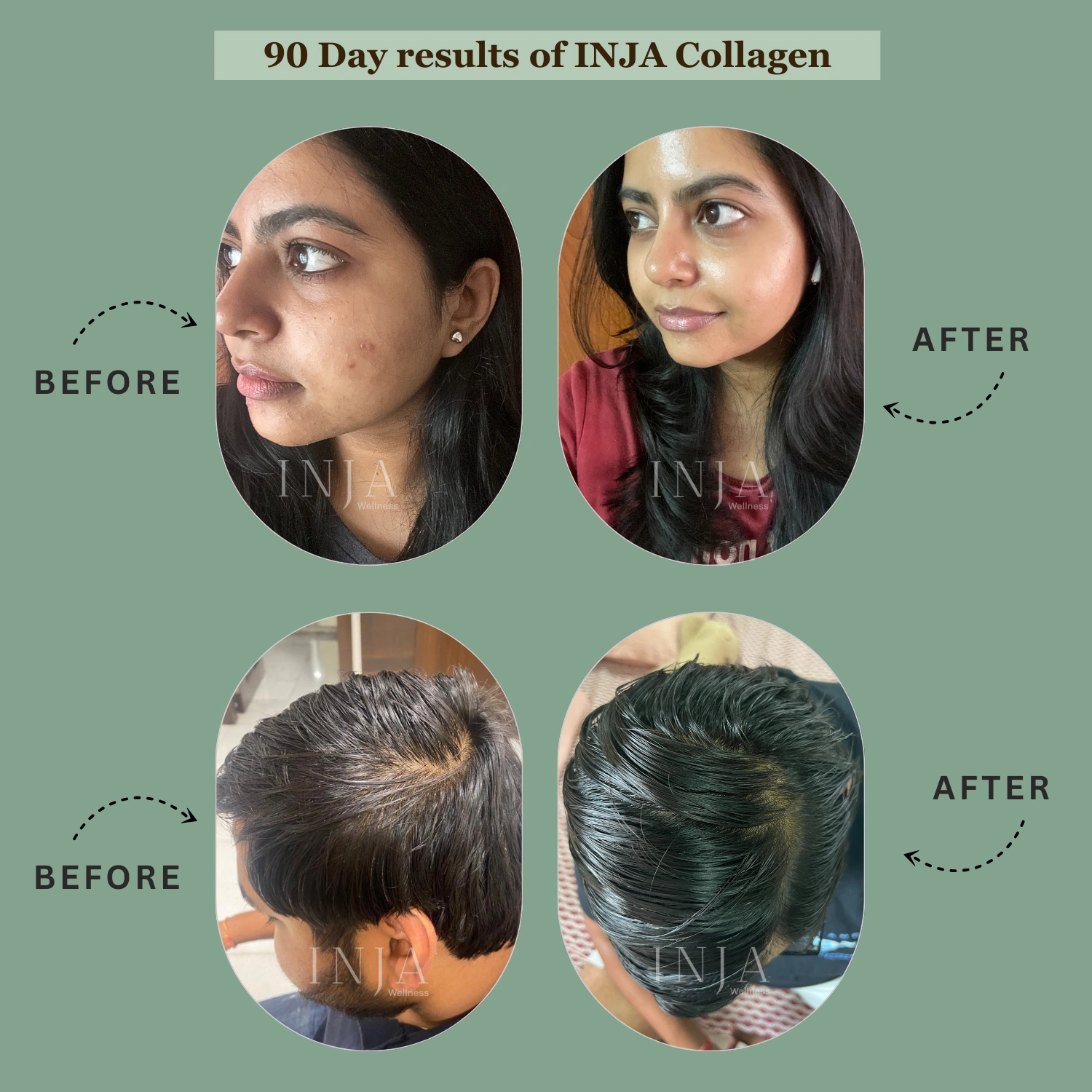 INJA Prime Finest Hydrolyzed Marine Collagen Unflavoured | Supports Skin, Hair, Nails, Joints & Bone Health - Image 3